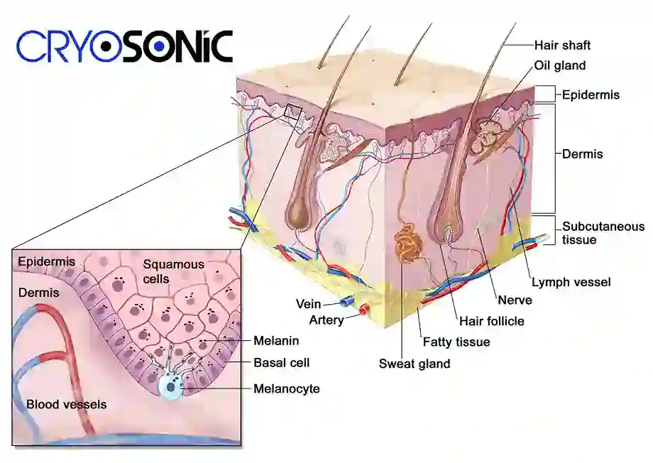 How Cryotherapy Stimulates Melanocyte Activity Stoke-on-Trent